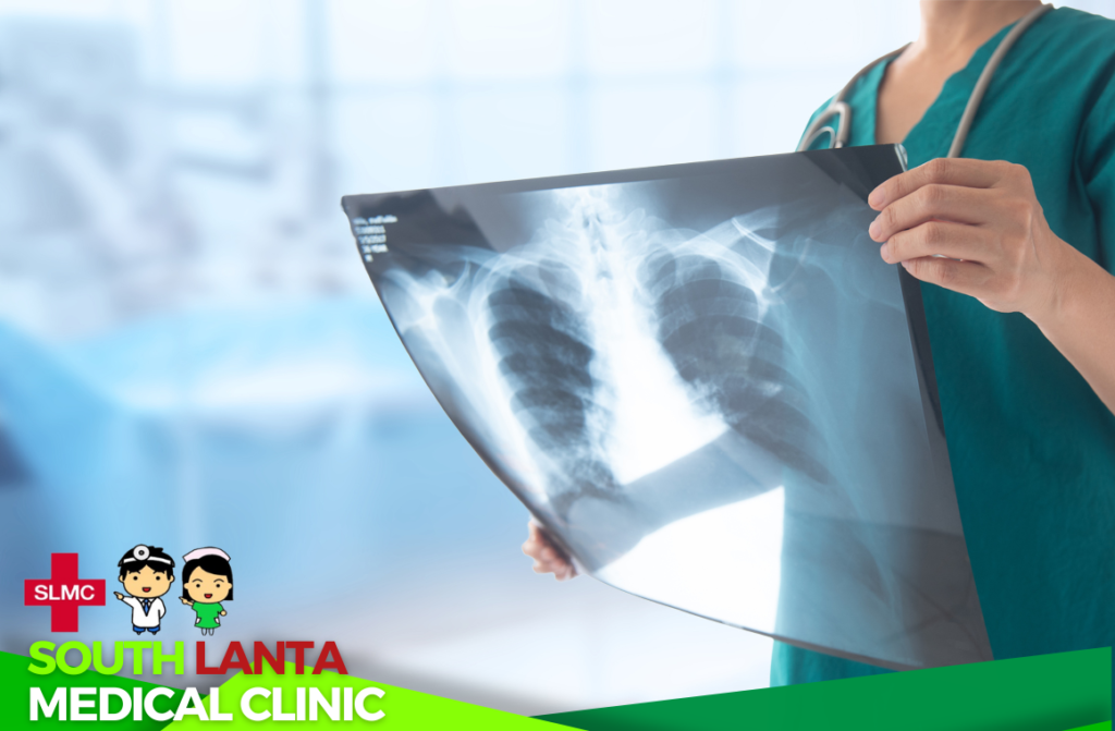 If you have any pain or injury, doctors might use an      x-ray to see if there are any broken bones or internal changes